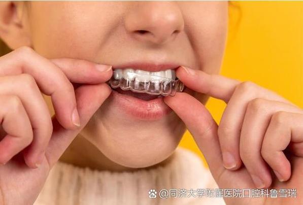 上海6岁孩子地包天矫正到底晚不晚