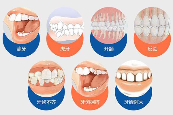 上海合肥隐形牙齿矫正费用贵不贵?要多少钱?