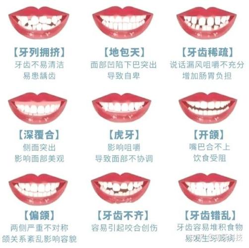 上海南京牙齿矫正价格多少?2024年整牙费用全解析