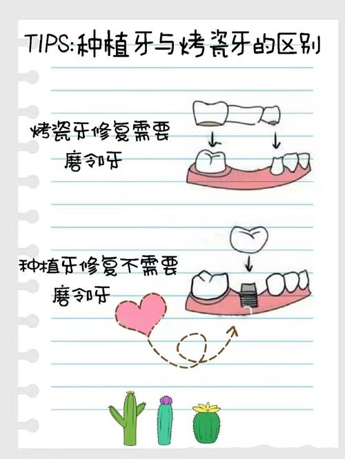 上海假牙和种植牙有什么区别 牙医告诉你哪种更划算