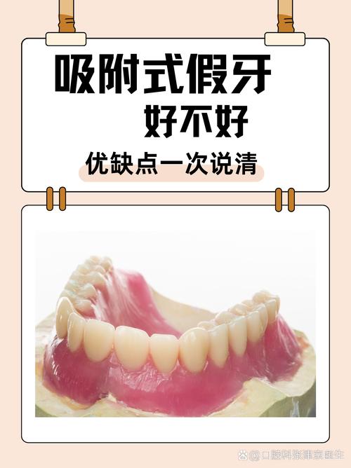 上海缺牙不种牙？活动假牙固定桥吸附性义齿哪个好