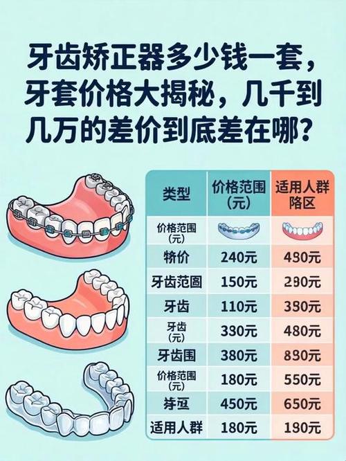上海7天矫正牙齿要多少钱 过来人告诉你真实价格与风险