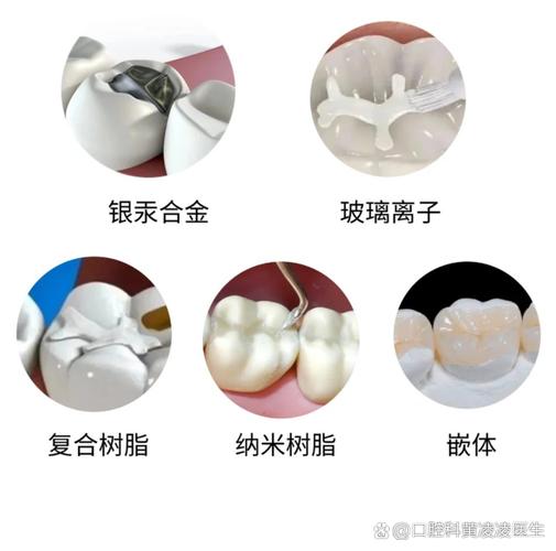 上海补牙用什么材料好？哪种补牙材料最靠谱？