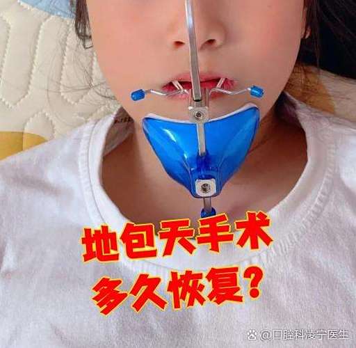 上海正颌手术矫正牙齿靠谱吗，效果能维持多久