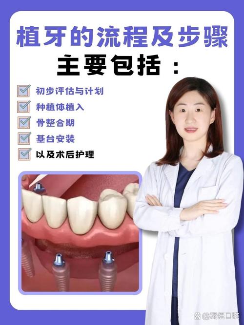 上海登特口腔植牙怎么样 缺牙必看攻略
