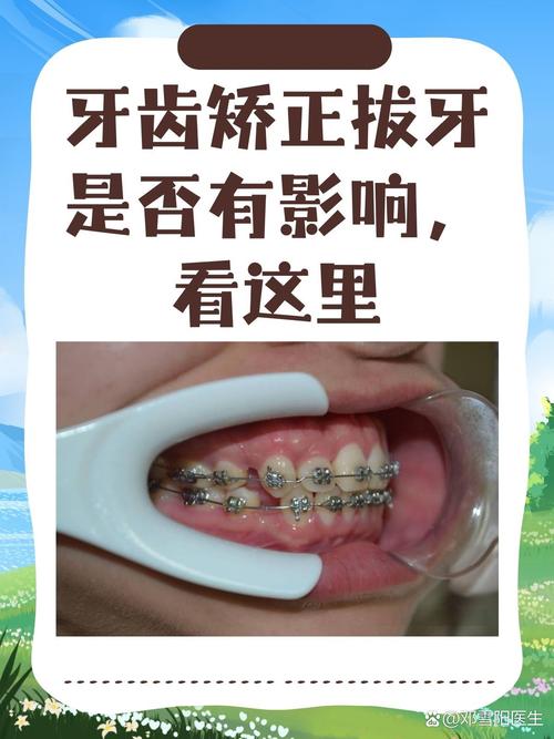 上海哪个医院牙齿矫正比较好 教你避开这3个坑