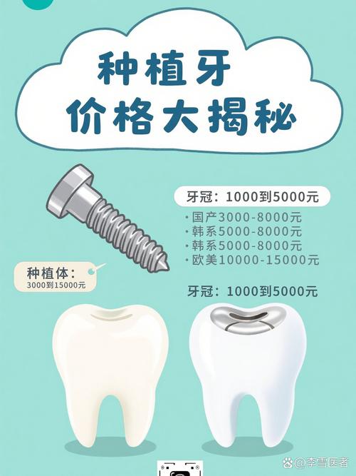 上海奥齿泰种牙多少钱一颗?2026年价格全解析