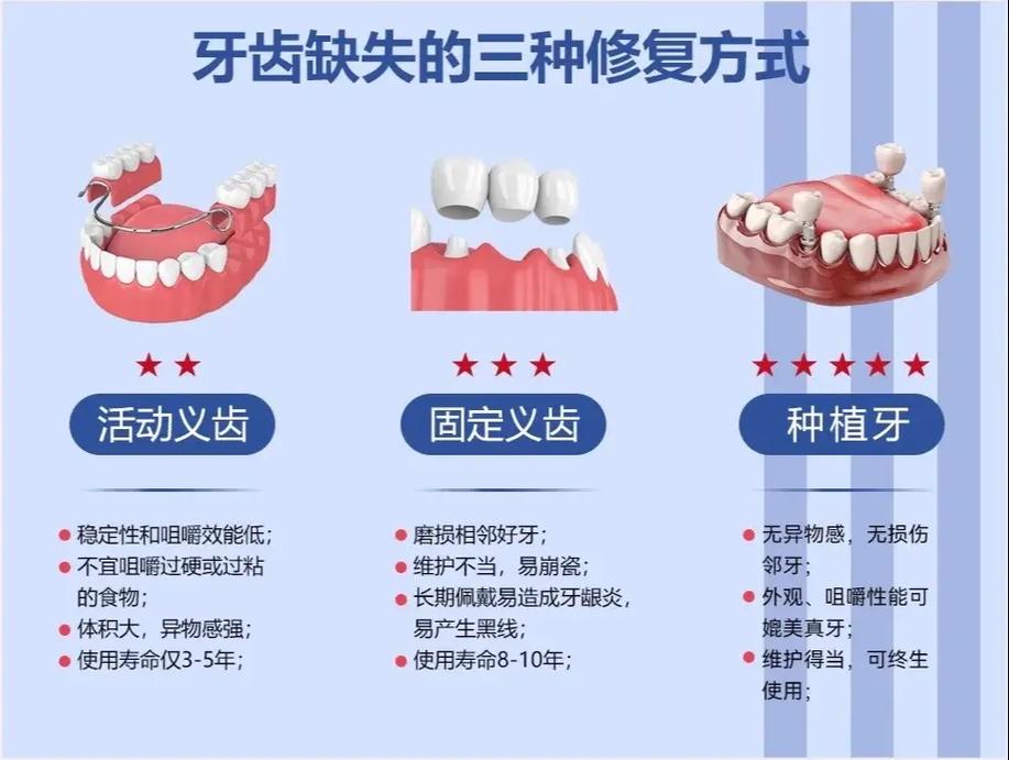 上海缺牙不种牙还有哪些靠谱的修复方法