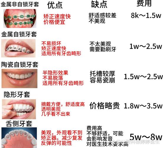 上海2023牙齿矫正报价公开:各类型价格一目了然