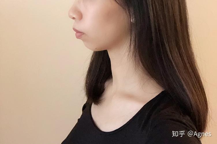 上海深圳龙岗隐适美矫正要多久？看完这篇就清楚了