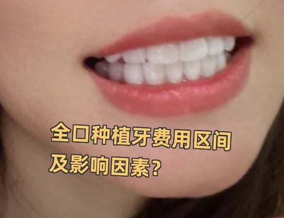 上海深圳罗湖骨量不足全口种牙大概多少钱
