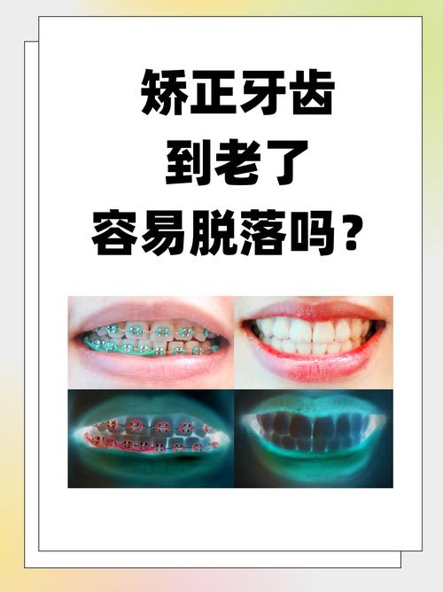 上海43岁矫正牙齿晚不晚 过来人告诉你答案