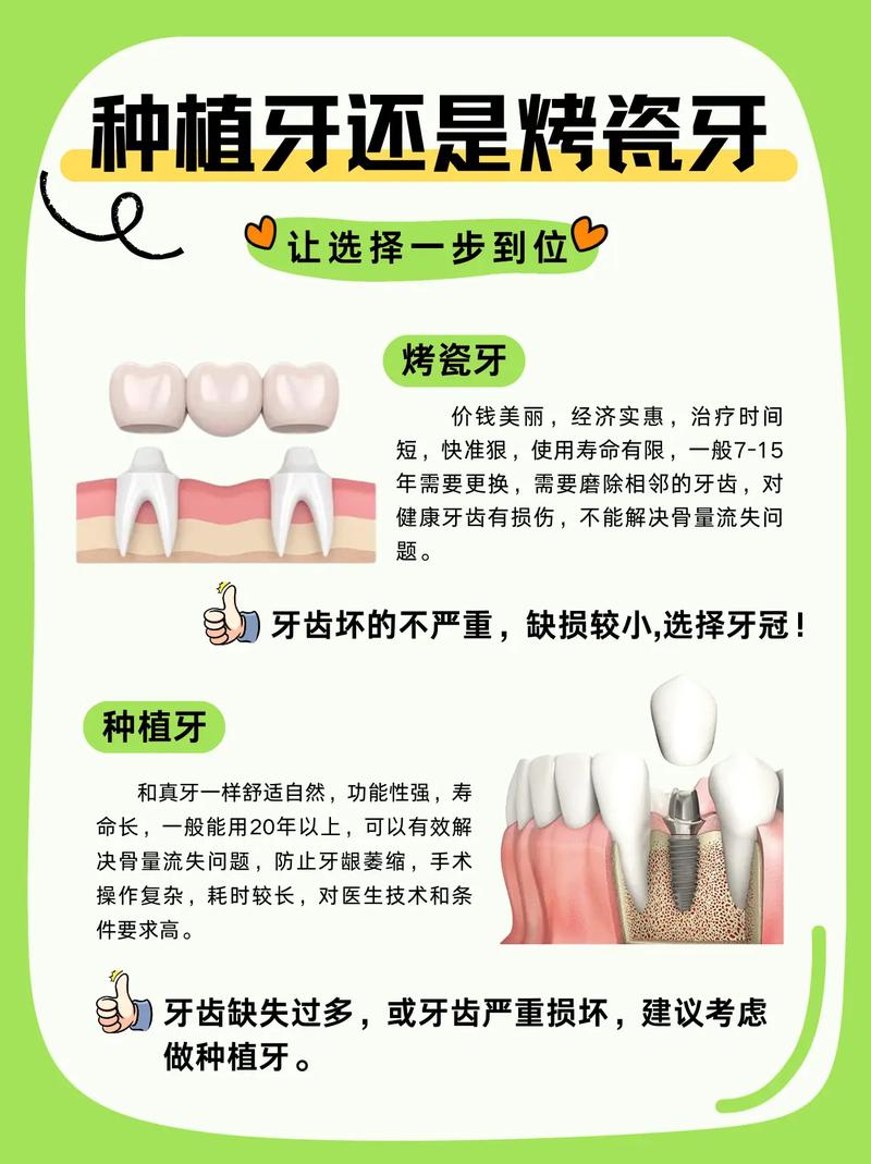 上海烤瓷牙还是种植牙 牙医教你选对修复方式