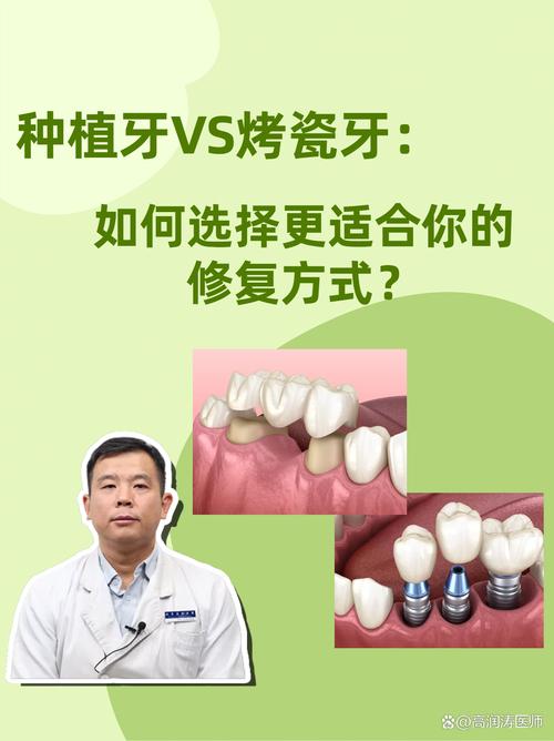 种植烤瓷牙好不好_按烤瓷牙还是种植牙_种植烤瓷牙多少钱一颗