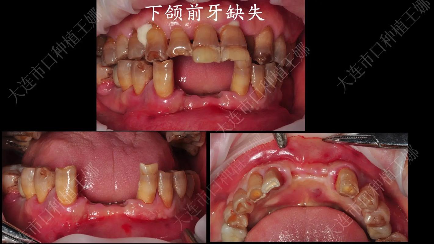 上海拔前牙能整好牙吗？真相与风险全解析