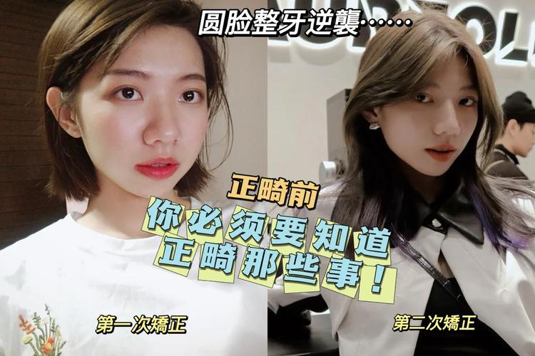 上海23岁整牙还来得及吗？过来人说实话