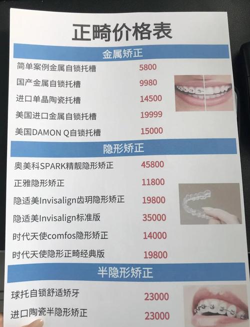 牙齿校正的一般费用_牙齿校正要多长时间_13岁牙齿校正多少钱