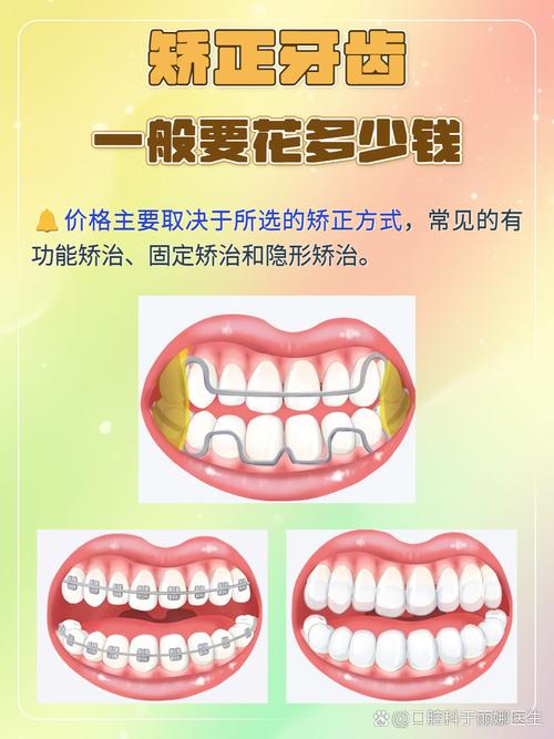 牙齿校正要多长时间_13岁牙齿校正多少钱_牙齿校正的一般费用