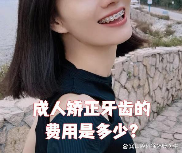 上海隐形矫正牙齿前必看 效果费用全解析