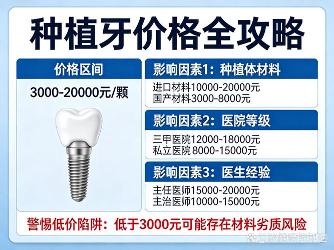 上海ITI种牙多少钱一颗?看完这篇不踩坑