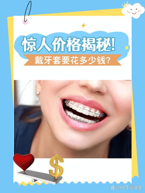上海矫正牙齿透明牙套到底要花多少钱 看完心里有底