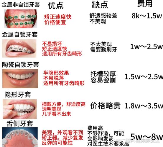 上海深圳福田青少年做钢丝牙套大概要花多少钱？