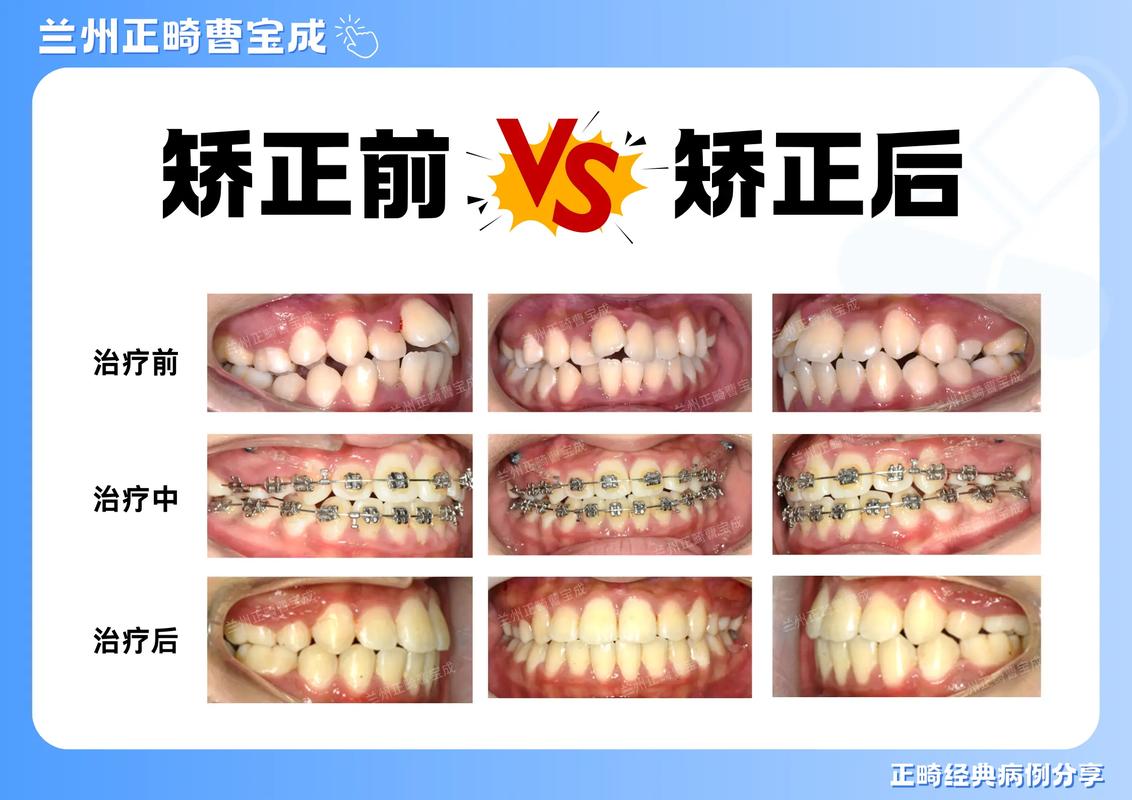 上海35岁做牙齿正畸晚吗？成人矫正前先看这3点
