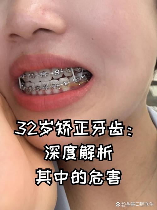 上海30岁以后能矫正牙齿吗？三十岁矫正效果及最佳年龄解析