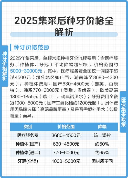 上海2025国产种植牙价格 集采后多少钱一颗