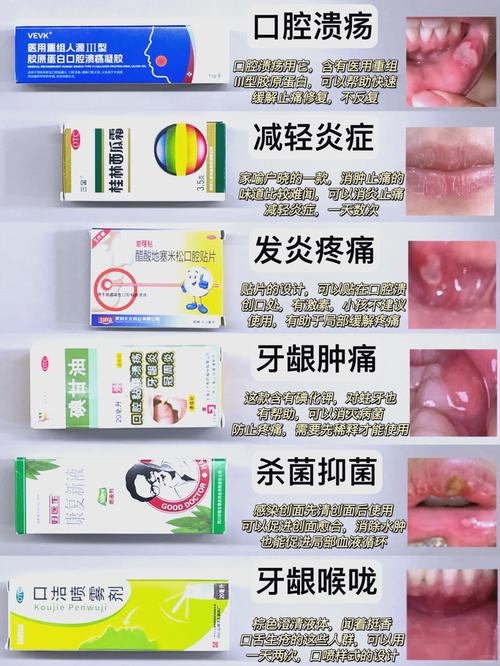 上海小孩口腔溃疡吃什么好的快?收下这份家庭偏方与饮食指南,轻松缓解娃的疼痛