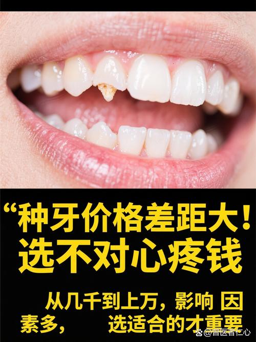 上海种植牙再等5年爆发？价格已降，技术更微创，缺牙患者有福了