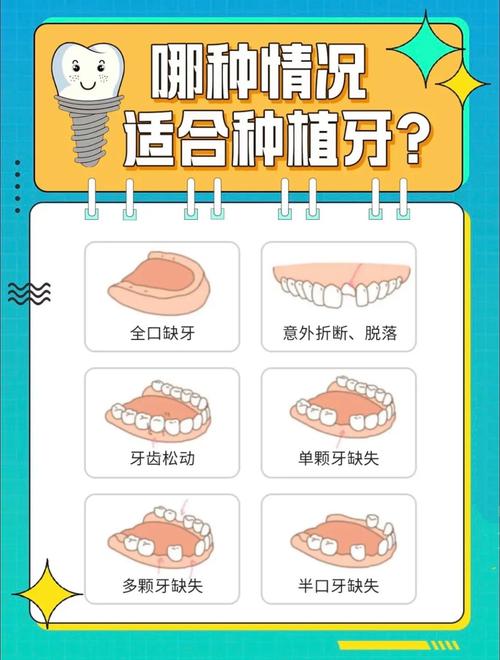 补牙和种牙哪个贵_补牙与种牙区别_补牙跟种牙的区别