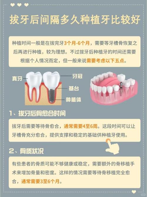 上海拔牙后必须马上种牙吗？等多久最合适