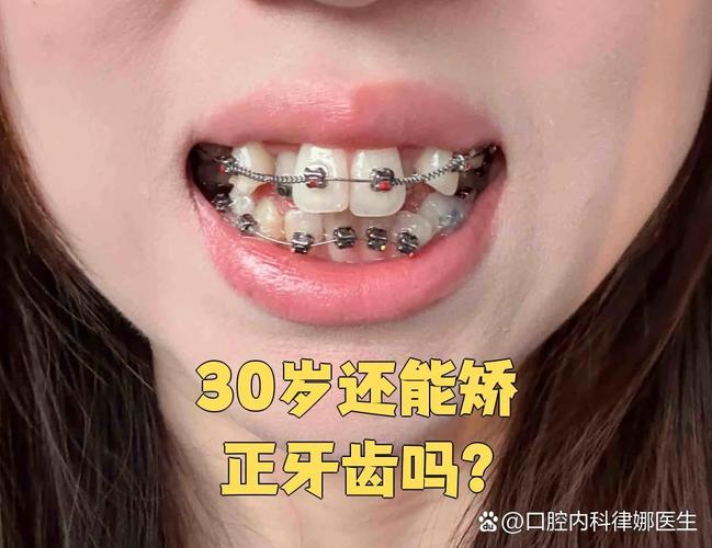 上海46岁牙齿矫正还来得及吗？别让年龄阻碍你的笑容