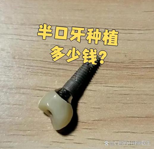 上海深圳宝安半口种牙多少钱 中老年价格详解