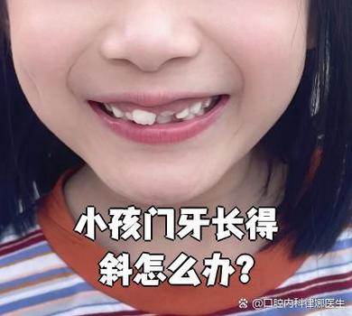 上海深圳孩子换牙门牙歪斜怎么办？专业干预指南与避坑建议