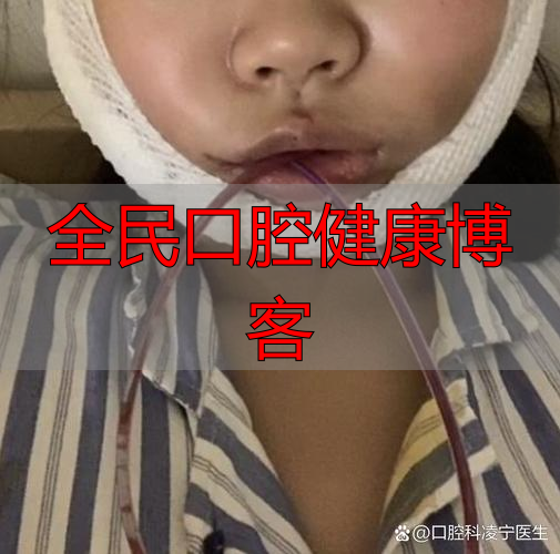 上海口腔颌面部受伤啥特点?不只影响呼吸进食,感染风险也很高