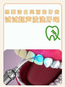 上海自己用超声波洗牙安全吗?洗牙是医疗行为,别自己瞎搞