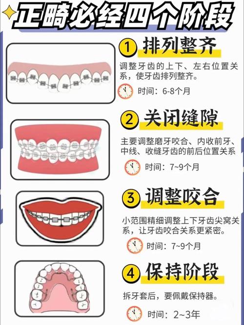 上海成人牙齿矫正全攻略：30-40岁做还来得及吗？需要几年时间？