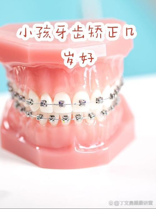 上海16岁牙齿矫正晚吗?医生:抓住黄金期,效果一样好