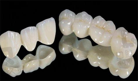 上海深圳全瓷牙哪家牙科好 真实经验分享