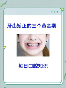 上海16岁矫正牙齿真的晚吗?抓住黄金期的尾巴,效果一样好