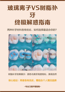 上海补牙材料有哪几种?牙医详解复合树脂和玻璃离子的优缺点