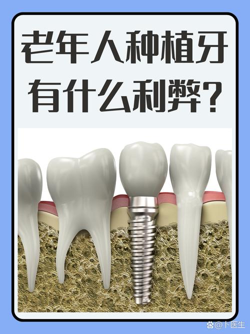 牙齿种植适合老人吗_65岁老人牙齿可以种植_老人家种植牙齿能正常吃饭吗