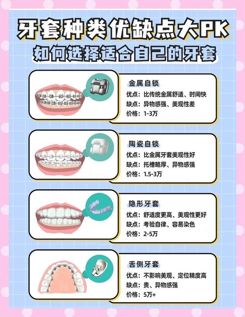 上海30岁还能做牙齿矫正吗成年人整牙全攻略