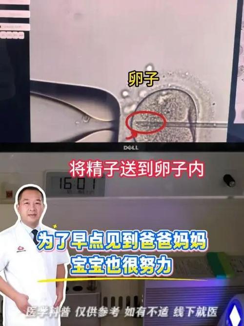 上海二代试管原理详解 卵胞浆内单精子注射如何助孕
