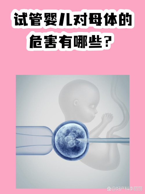 上海试管婴儿常见问题解答 你想知道的都在这