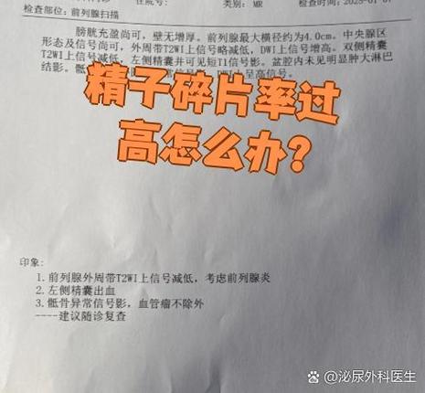 上海精子DNA碎片率高怎么办 影响生育吗