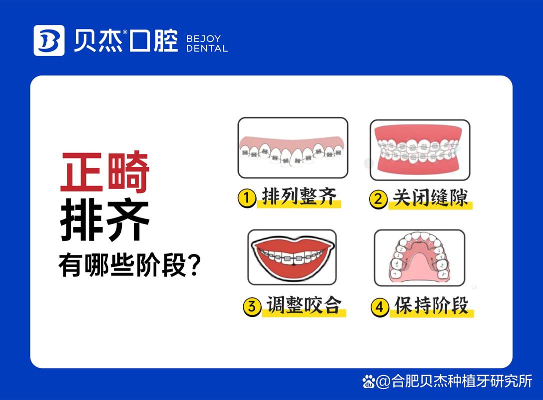 上海儿童牙齿排列不齐去哪家医院矫正效果最好？