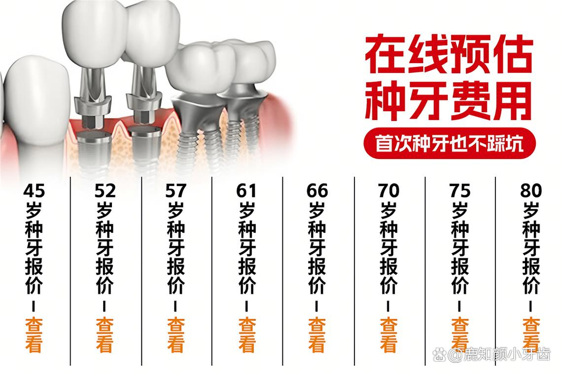 深圳口腔医院种植牙价格表_连锁口腔机构_深圳连锁口腔种植牙报价对比